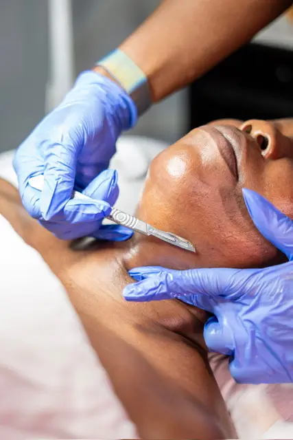 A dermaplane treatment performed with precision at Meticulous Spa