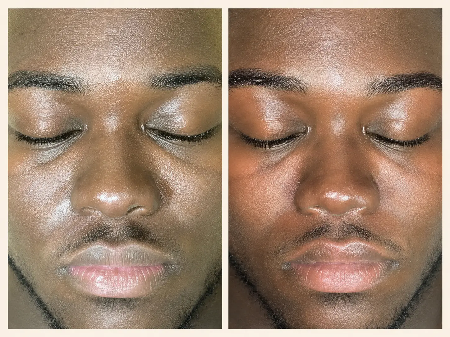 Published Meticulous Spa facial photographs for a male client